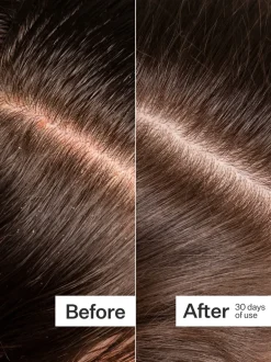 Act+Acre Microbiome Cooling Scalp Serum | MECCA