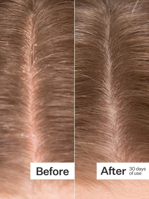 Act+Acre Microbiome Cooling Scalp Serum | MECCA