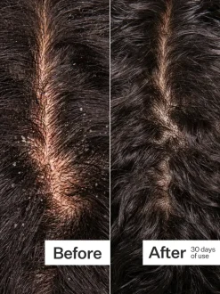 Act+Acre Microbiome Cooling Scalp Serum | MECCA