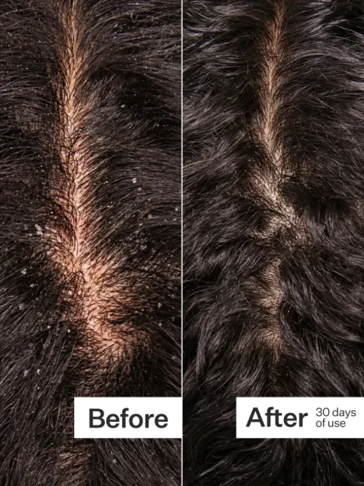 Act+Acre Microbiome Cooling Scalp Serum | MECCA