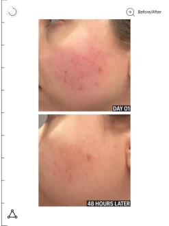 Allies of Skin Molecular Barrier Recovery Cream Balm | MECCA