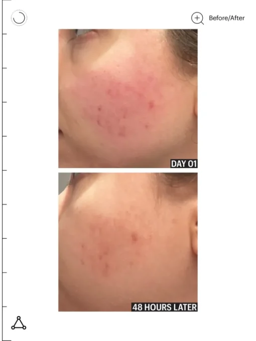 Allies of Skin Molecular Barrier Recovery Cream Balm | MECCA