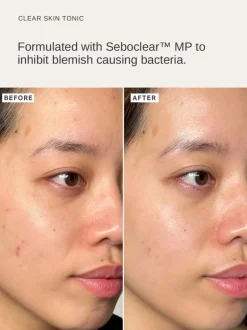 Alpha-H Clear Skin Daily Hydrator Gel with 2.5% Niacinamide | MECCA