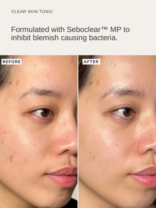 Alpha-H Clear Skin Daily Hydrator Gel with 2.5% Niacinamide | MECCA