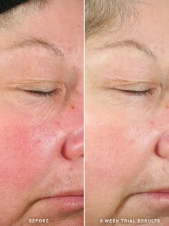 Alpha-H Generation Glow Daily Resurfacing Essence | MECCA