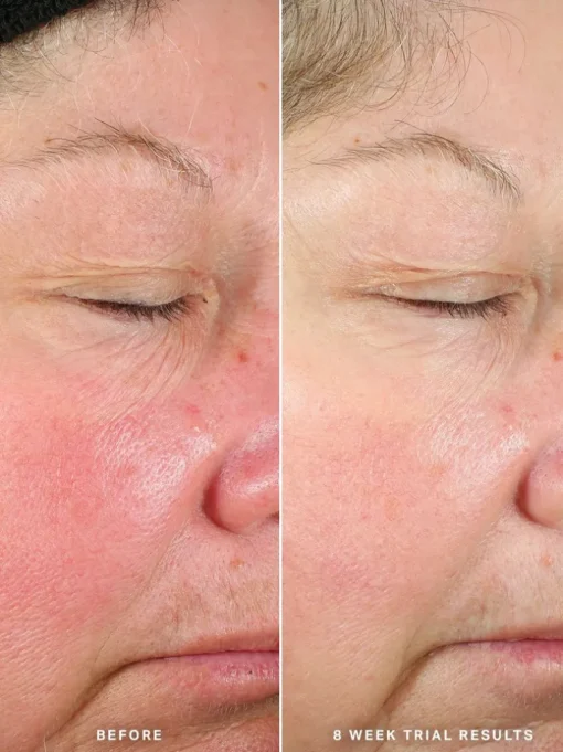 Alpha-H Generation Glow Daily Resurfacing Essence | MECCA