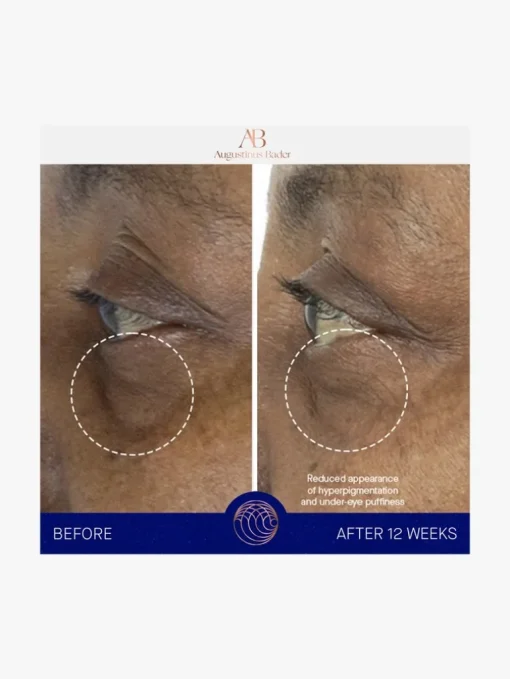 Augustinus Bader The Eye Cream | MECCA