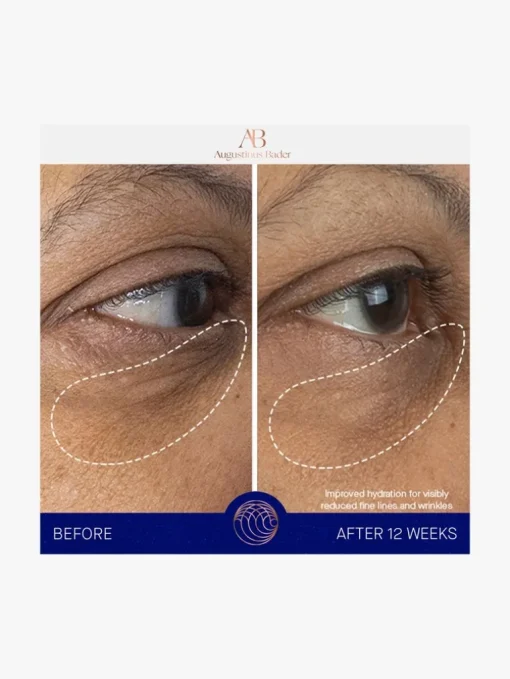 Augustinus Bader The Eye Cream | MECCA
