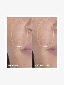 BeautyBio Cryo Dual Ended Roller | MECCA