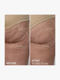 BeautyBio GloPro® Body MicroTip™ Attachment | MECCA