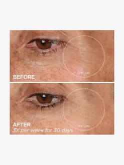 BeautyBio Glopro® Eye Microtip™ | MECCA