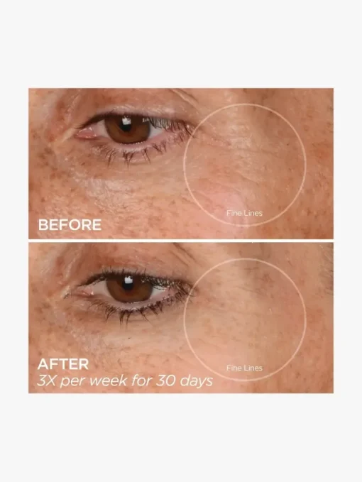 BeautyBio Glopro® Eye Microtip™ | MECCA
