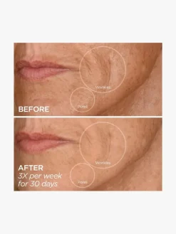 BeautyBio GloPro® Face Microtip™ | MECCA