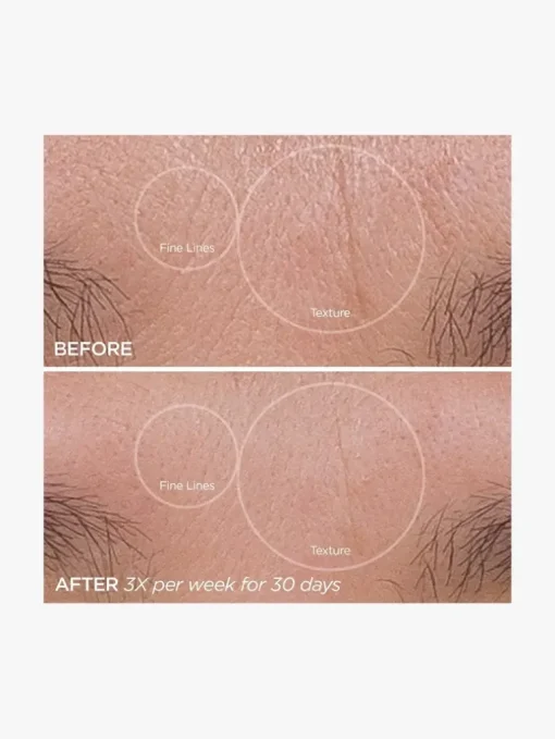 BeautyBio GloPro® Face Microtip™ | MECCA