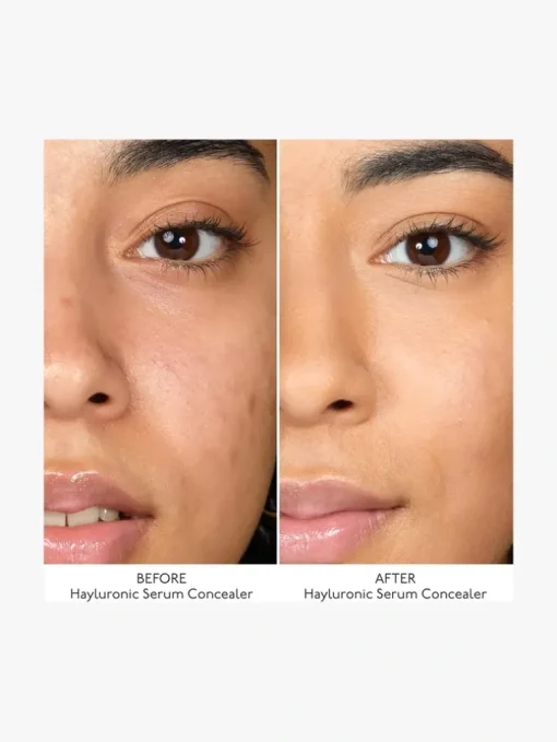 By Terry Hyaluronic Serum Concealer   | MECCA