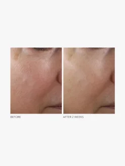 Dr Dennis Gross Advanced Retinol + Ferulic Texture Renewal Serum