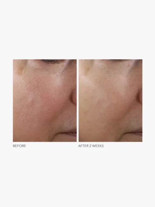 Dr Dennis Gross Advanced Retinol + Ferulic Texture Renewal Serum