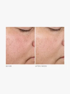 Dr Dennis Gross Advanced Retinol + Ferulic Texture Renewal Serum