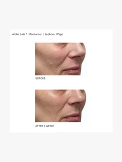 Dr Dennis Gross Alpha Beta Daily Moisturizer | MECCA