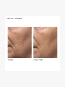 Dr Dennis Gross Alpha Beta Daily Moisturizer | MECCA