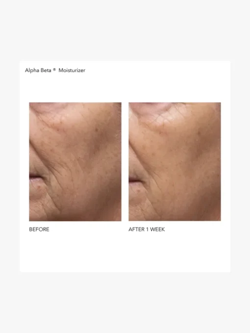 Dr Dennis Gross Alpha Beta Daily Moisturizer | MECCA