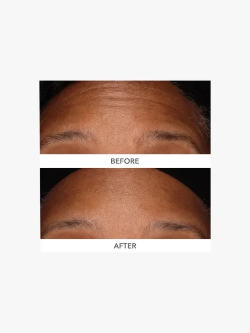 Dr. Dennis Gross DermInfusions 3D Plump, Fill and Repair | MECCA