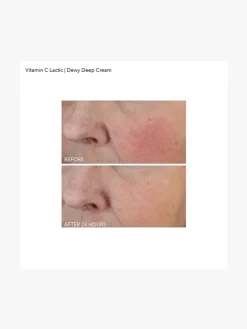 Dr Dennis Gross Vitamin C + Lactic Dewy Deep Cream | MECCA