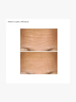 Dr Dennis Gross Vitamin C+Lactic 15% Vitamin C Firm & Bright Serum | MECCA