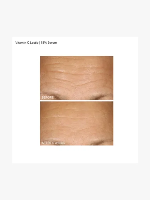 Dr Dennis Gross Vitamin C+Lactic 15% Vitamin C Firm & Bright Serum | MECCA