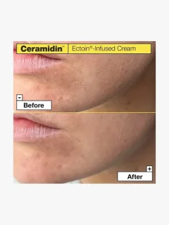 Dr. Jart+ Ceramidin Ectoin-Infused Cream | MECCA