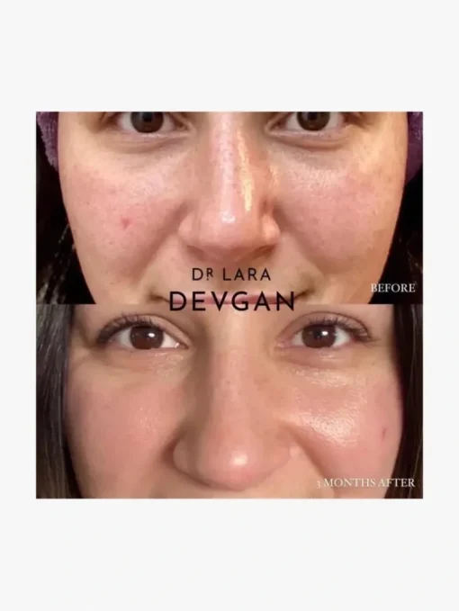 Dr. Lara Devgan Retinol Bakuchiol Serum 5x | MECCA
