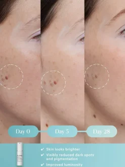 ELEMIS Dynamic Resurfacing Super-C Serum | MECCA