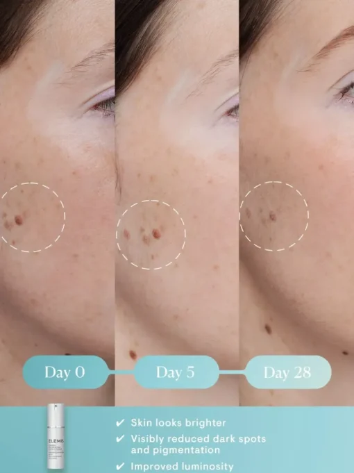 ELEMIS Dynamic Resurfacing Super-C Serum | MECCA