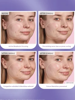 Glow Recipe Blackberry Retinol Serum | MECCA