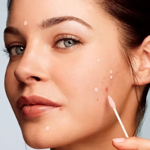 Kate Somerville EradiKate Acne Treatment | MECCA