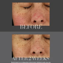 Kate Somerville Total Repair Cream KateCeuticals | MECCA