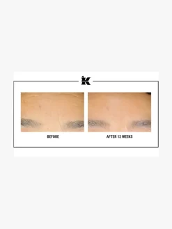 Kiehls's Retinol Skin-Renewing Daily Micro-Dose Treatment | MECCA
