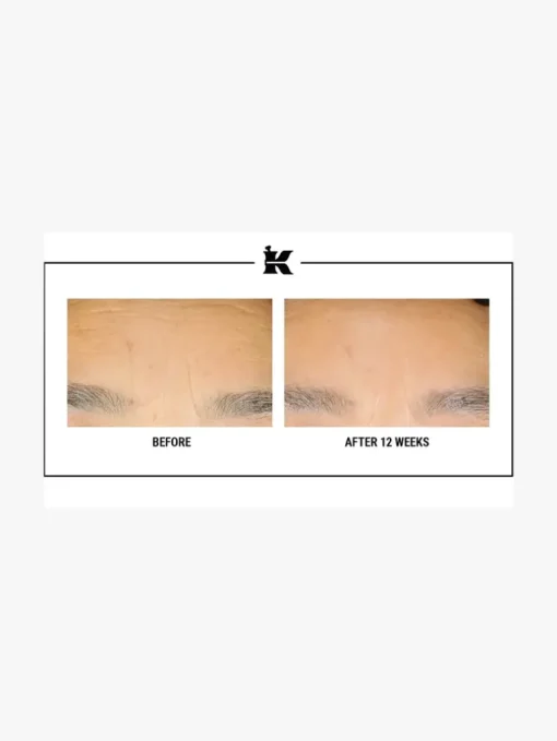 Kiehls's Retinol Skin-Renewing Daily Micro-Dose Treatment | MECCA