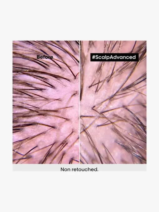L'Oreal Professionnel Scalp Advanced Anti-Discomfort Treatment | MECCA