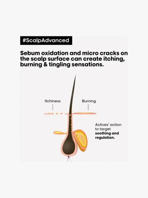 L'Oreal Professionnel Scalp Advanced Anti-Discomfort Treatment | MECCA