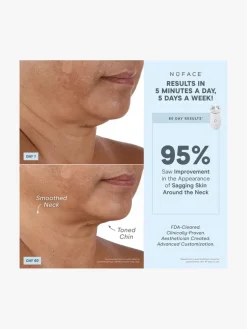 NuFACE Effective Lip & Eye Attachment | MECCA