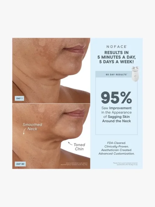 NuFACE Effective Lip & Eye Attachment | MECCA