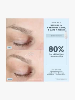 NuFACE Effective Lip & Eye Attachment | MECCA