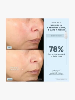 NuFACE Effective Lip & Eye Attachment | MECCA