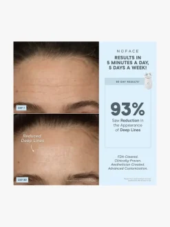 NuFACE Effective Lip & Eye Attachment | MECCA