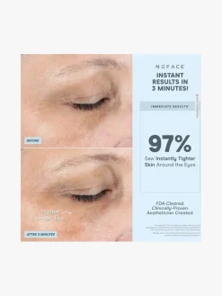 NuFACE Fix Device | MECCA