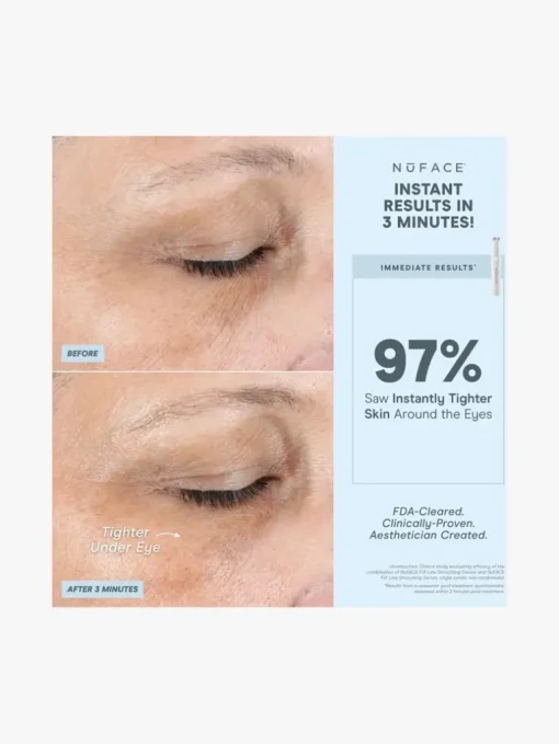 NuFACE Fix Device | MECCA