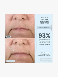 NuFACE Fix Device | MECCA