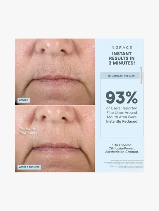 NuFACE Fix Device | MECCA