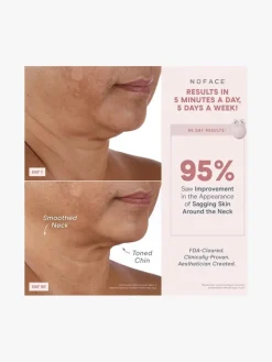 NuFACE Mini+ Starter Kit | MECCA